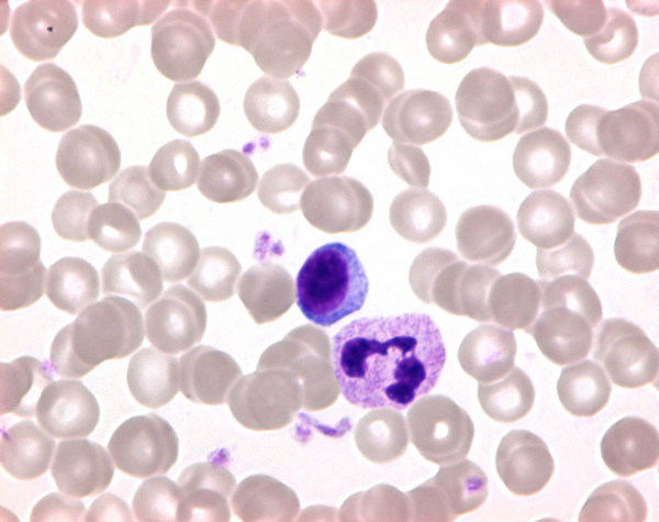 Giemsa's  Azur-Eosin-Methylene Blue  25grm