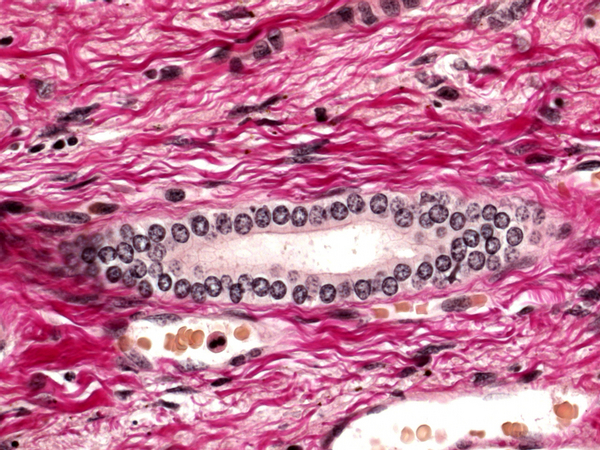 Fuchsin Acid (C.I. 42685 )   25Grm