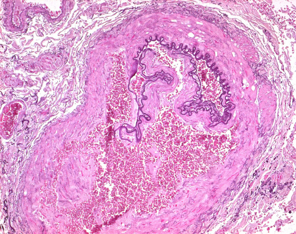 Fuchsin for Microscopy 100G