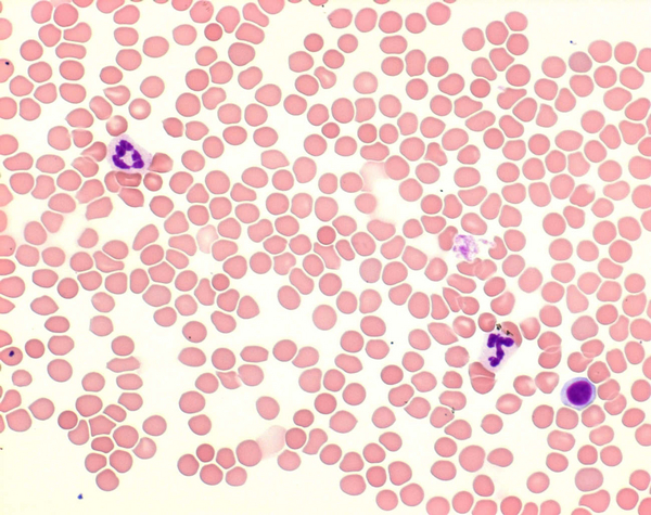 Giemsa's Azur Eosin Methylene Blue Soln 100mL